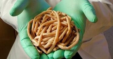 паразити, извлечени от човешкото тяло