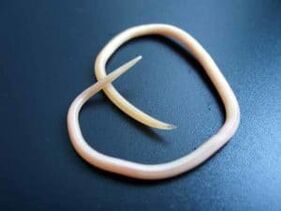 Човешки кръгъл червей, извлечен от тялото