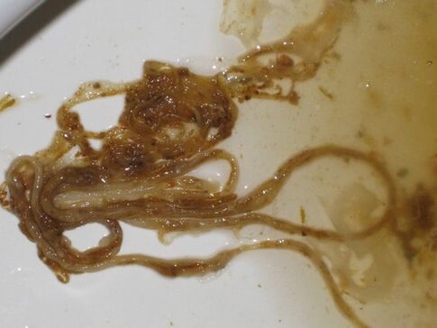 червеи, паразити от човешкото тяло