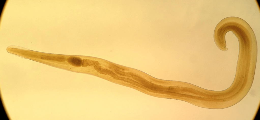 Pinworm е често срещан паразит сред децата. 